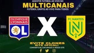 Assistir Lyon x Nantes AO VIVO Online 06/10/2024